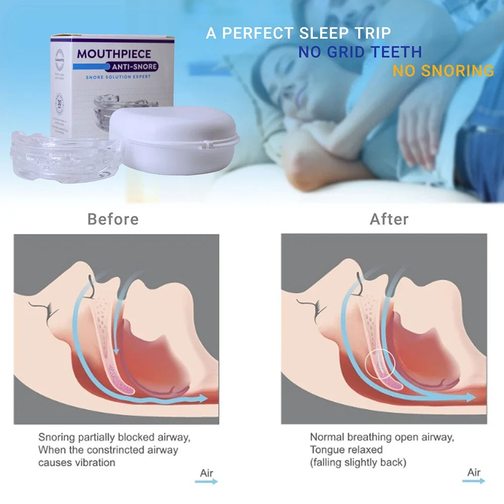 Reusable Anti Snore Mouth Guard with Storage Box Anti Snoring Bruxism Mouth Guard Improve Sleeping Reduction Snoring Device